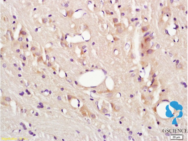 红霉素单克隆抗体