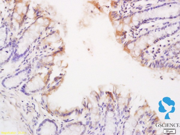 磺胺索嘧啶单克隆抗体