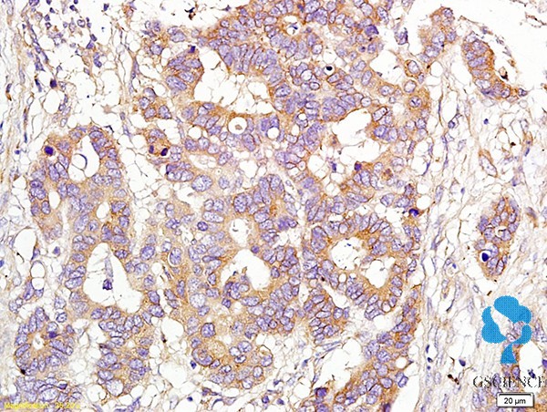 磺胺喹噁啉单克隆抗体