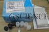 人白细胞分化抗原15（CD15）ELISA试剂盒