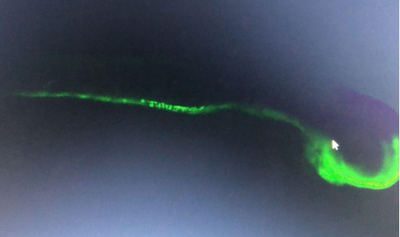 VASA Rabbit Polyclonal   Antibody